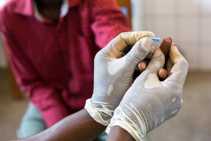 Journée mondiale du Sida : A Beni, 756 personnes ont contracté la maladie depuis janvier 2020