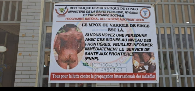 Lutte contre Mpox en RDC : La société civile déplore l’inaction du gouvernement à Kasindi